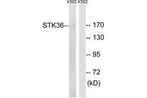 Western Blotting (WB) image for anti-serine/threonine Kinase 36 (STK36) (AA 387-436) antibody (ABIN2879207) (STK36 antibody  (AA 387-436))