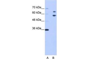 Western Blotting (WB) image for anti-TROVE Domain Family, Member 2 (TROVE2) antibody (ABIN2462170) (TROVE2 antibody)