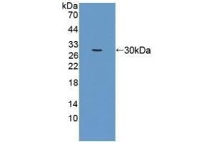Detection of Recombinant EEF1a1, Human using Polyclonal Antibody to Eukaryotic Translation Elongation Factor 1 Alpha 1 (EEF1a1) (eEF1A1 antibody  (AA 1-241))