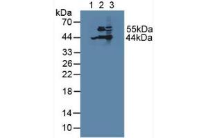 Western blot analysis of (1) Human HepG2 Cells, (2) Porcine Liver Tissue and (3) Mouse Liver Tissue. (ACAT2 antibody  (AA 1-397))