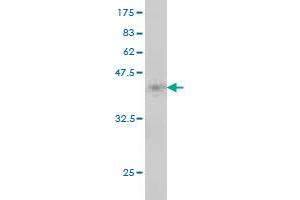 Western Blot detection against Immunogen (37. (MTRR antibody  (AA 1-110))