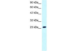 WB Suggested Anti-FLJ11730 Antibody Titration: 0. (FLJ11730 (N-Term) antibody)