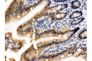 Anti- OGT Picoband antibody,IHC(P) IHC(P): Mouse Intestine Tissue (OGT antibody  (C-Term))