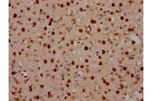 IHC image of ABIN7150394 diluted at 1:100 and staining in paraffin-embedded human brain tissue performed on a Leica BondTM system. (SATB2 antibody  (AA 228-369))