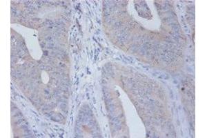 Immunohistochemistry of paraffin-embedded human placenta tissue using ABIN7156785 at dilution of 1:100 (IL12B antibody  (AA 23-328))