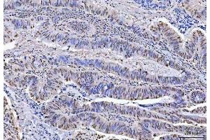 IHC analysis of KAP1 using anti-KAP1 antibody (ABIN3043491). (KAP1 antibody  (AA 699-835))