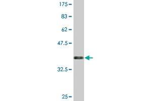 Western Blot detection against Immunogen (36. (CLEC10A antibody  (AA 70-169))
