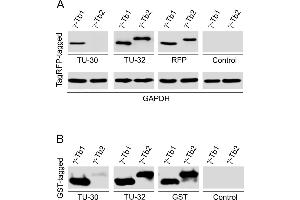 Western blotting analysis of differential reactivity of monoclonal antibodies to γ-tubulin with human γ-tubulin isotypes. (TUBG1 antibody  (AA 434-449))