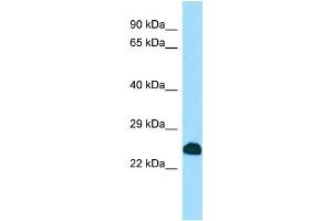 WB Suggested Anti-SCNM1 Antibody Titration: 1. (SCNM1 antibody  (C-Term))