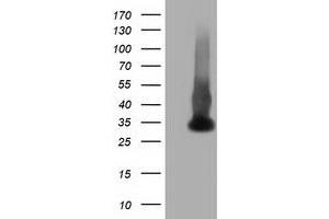 HEK293T cells were transfected with the pCMV6-ENTRY control (Left lane) or pCMV6-ENTRY ERCC1 (Right lane) cDNA for 48 hrs and lysed. (ERCC1 antibody)