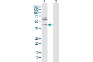 Western Blot analysis of FOXP3 expression in transfected 293T cell line by FOXP3 MaxPab polyclonal antibody. (FOXP3 antibody  (AA 1-431))