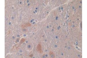 Used in DAB staining on fromalin fixed paraffin- embedded liver tissue (IL18BP antibody  (AA 29-193))
