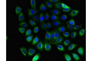 Immunofluorescent analysis of A549 cells using ABIN7154745 at dilution of 1:100 and Alexa Fluor 488-congugated AffiniPure Goat Anti-Rabbit IgG(H+L) (GNB5 antibody  (AA 1-353))