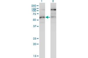 Western Blotting (WB) image for anti-serine/threonine Kinase 38 Like (STK38L) (AA 1-465) antibody (ABIN599531) (STK38L antibody  (AA 1-465))