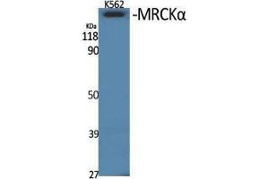 anti-CDC42 Binding Protein Kinase alpha (DMPK-Like) (CDC42BPA) (Internal Region) antibody
