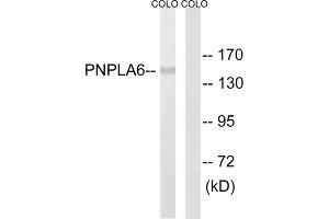 Western blot analysis of extracts from COLO205 cells, using PNPLA6 antibody. (PNPLA6 antibody  (N-Term))