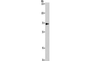Gel: 8 % SDS-PAGE, Lysate: 40 μg, Lane: Hela cells, Primary antibody: ABIN7131154(SPATA13 Antibody) at dilution 1/200, Secondary antibody: Goat anti rabbit IgG at 1/8000 dilution, Exposure time: 5 seconds (SPATA13 antibody)