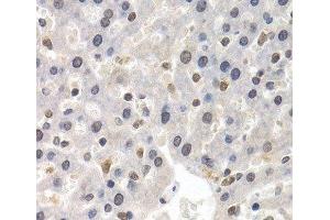 Immunohistochemistry of paraffin-embedded Rat liver using GTF2F1 Polyclonal Antibody at dilution of 1:200 (40x lens). (GTF2F1 antibody)