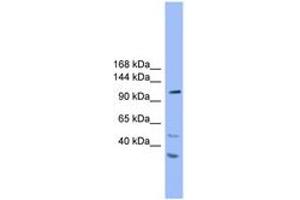 Image no. 1 for anti-StAR-Related Lipid Transfer (START) Domain Containing 8 (STARD8) (AA 201-250) antibody (ABIN6746633) (STARD8 antibody  (AA 201-250))