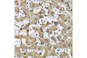 Immunohistochemistry of paraffin-embedded human liver using MAK antibody (ABIN7268382) at dilution of 1:100 (40x lens). (MAK antibody  (AA 370-435))