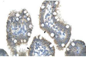 Human Intestine; ZNF498 antibody - middle region in Human Intestine cells using Immunohistochemistry (Zinc Finger and SCAN Domain Containing 25 (ZSCAN25) (Middle Region) antibody)