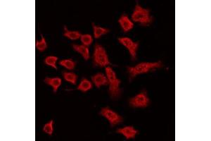 ABIN6269391 staining MDA-MB-435 by IF/ICC. (ASK1 antibody  (N-Term))