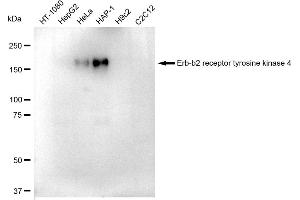 Western blotting analysis using Erb-b2 receptor tyrosine kinase 4 antibody (ABIN7800793).