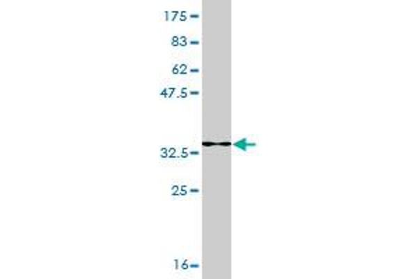 SMARCA2 antibody  (AA 659-735)