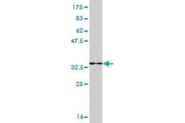 SMARCA2 antibody  (AA 659-735)