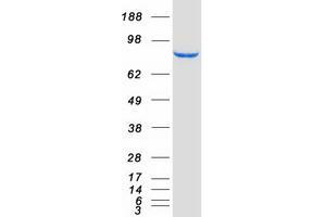 Validation with Western Blot