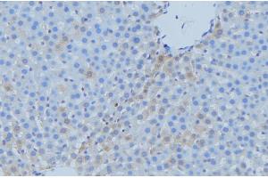 ABIN6273742 at 1/100 staining Mouse liver tissue by IHC-P. (CYP7A1 antibody  (Internal Region))
