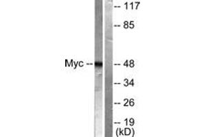 Western Blotting (WB) image for anti-Myc Proto-Oncogene protein (MYC) (AA 31-80) antibody (ABIN2888572) (c-MYC antibody  (AA 31-80))