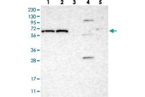 Western blot analysis of Lane 1: RT-4, Lane 2: U-251 MG, Lane 3: Human Plasma, Lane 4: Liver, Lane 5: Tonsil with IFFO2 polyclonal antibody .
