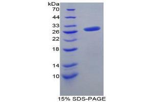 SDS-PAGE (SDS) image for Fibroblast Growth Factor 23 (FGF23) (AA 25-251) protein (His tag) (ABIN1880092) (FGF23 Protein (AA 25-251) (His tag))