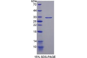 SDS-PAGE (SDS) image for Promyelocytic Leukemia (PML) ELISA Kit (ABIN6720583)
