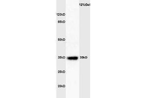 Mouse spleen lysates probed with Rabbit Anti-GATA-1 Polyclonal Antibody  at 1:3000 90min in 37˚C.
