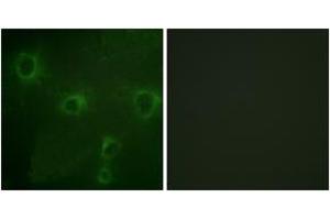 Immunofluorescence analysis of COS7 cells, using Kv2. (Kv2.1/KCNB1 antibody  (AA 533-582))
