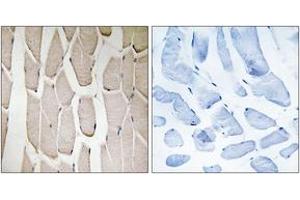 Immunohistochemistry analysis of paraffin-embedded human heart tissue, using MARCH3 Antibody. (MARCH3 antibody  (AA 111-160))