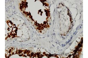 Immunoperoxidase of monoclonal antibody to ART3 on formalin-fixed paraffin-embedded human testis. (ART3 antibody  (AA 29-138))