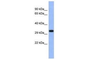 Image no. 1 for anti-Upstream Transcription Factor 1 (USF1) (C-Term) antibody (ABIN6742512) (USF1 antibody  (C-Term))