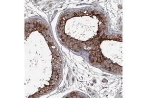 Immunohistochemical staining of human testis with FLVCR2 polyclonal antibody  shows strong cytoplasmic and membranous positivity in cells of seminiferus ducts.
