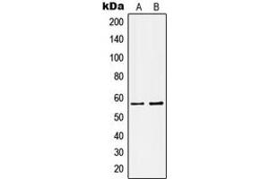 Western blot analysis of Kv1. (KCNA1 antibody  (Center))