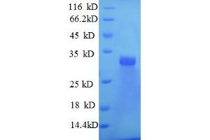 SDS-PAGE (SDS) image for Laminin, beta 2 (Laminin S) (LAMB2) (AA 1530-1798), (partial) protein (His tag) (ABIN4976526) (LAMB2 Protein (AA 1530-1798, partial) (His tag))