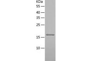 Western Blotting (WB) image for Junction Mediating and Regulatory Protein, P53 Cofactor (JMY) (AA 163-341) protein (His tag) (ABIN7287945) (JMY Protein (AA 163-341) (His tag))