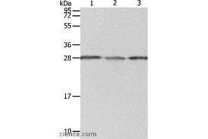 Western blot analysis of A549 cell, human liver cancer and fetal kidney tissue, using PSMD9 Polyclonal Antibody at dilution of 1:800
