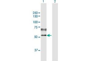Western Blot analysis of PSAP expression in transfected 293T cell line by PSAP MaxPab polyclonal antibody. (Prosaposin antibody  (AA 1-524))