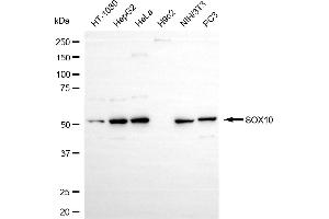Western blotting analysis using SOX10 antibody (ABIN7800972).