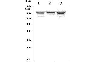Western blot analysis of ADAM15 using anti-ADAM15 antibody (ABIN7601669).