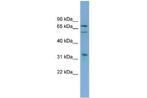 WB Suggested Anti-TBX18 Antibody Titration:  0. (T-Box 18 antibody  (N-Term))