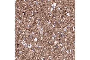 Immunohistochemical staining of human cerebral cortex with SGIP1 polyclonal antibody ( Cat # PAB28015 ) shows distinct cytoplasmic positivity in a fraction of neuronal cells at 1:10 - 1:20 dilution.